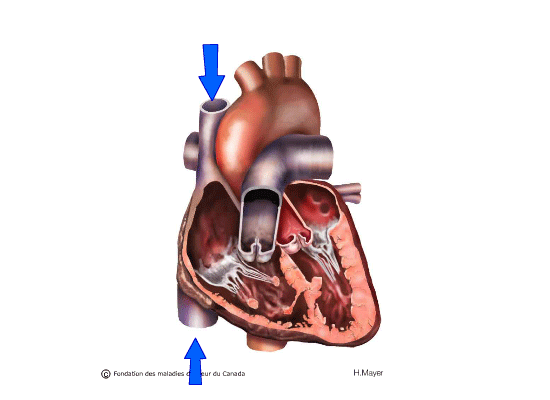 Maladies des valves cardiaques - Centre Cœur et Santé